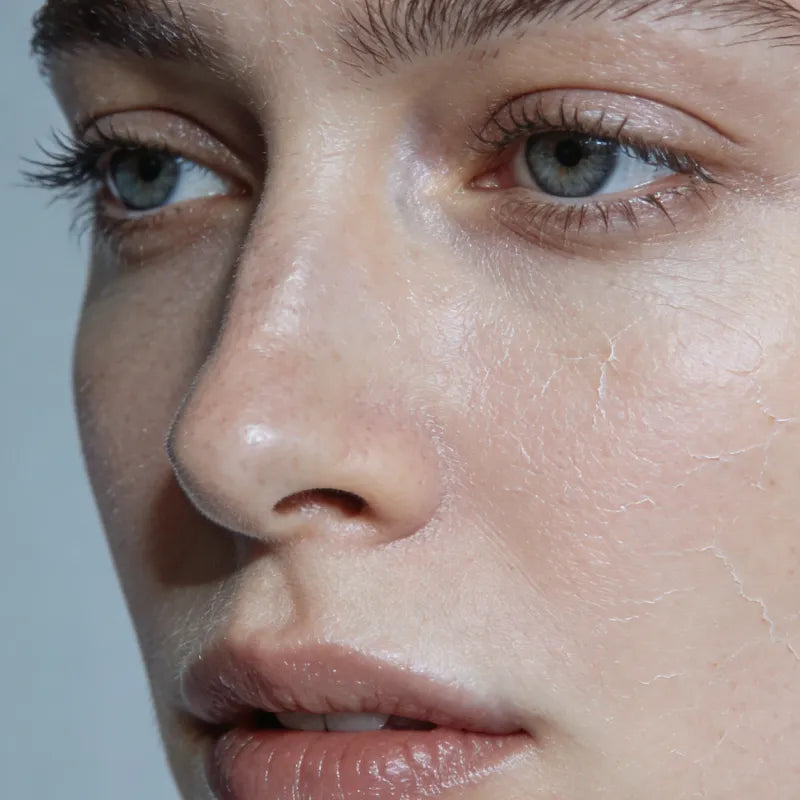 Anti Aging